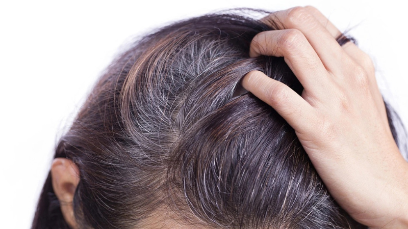 Cách trị tóc bạc sớm