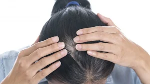 Bài thuốc chữa tóc bạc sớm