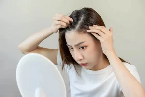 Da đầu yếu 