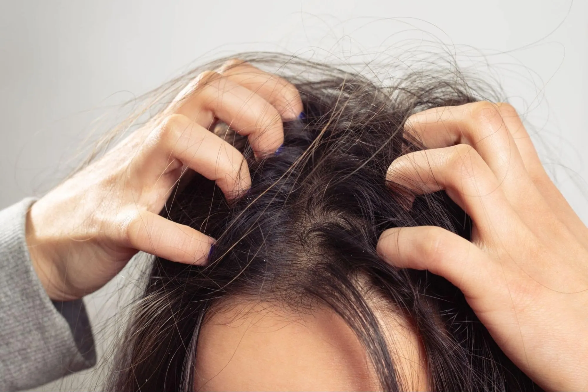 Dầu gội trị khô da đầu chị em nên tham khảo