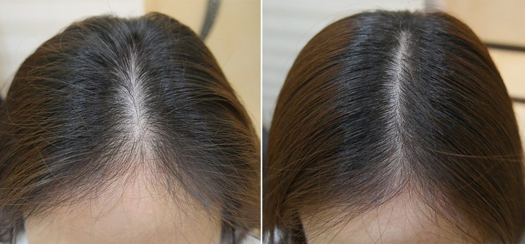 Kích thích mọc tóc