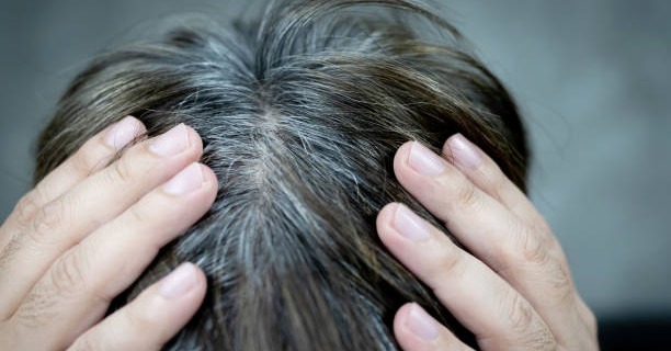 Có phải máu xấu gây tóc bạc sớm