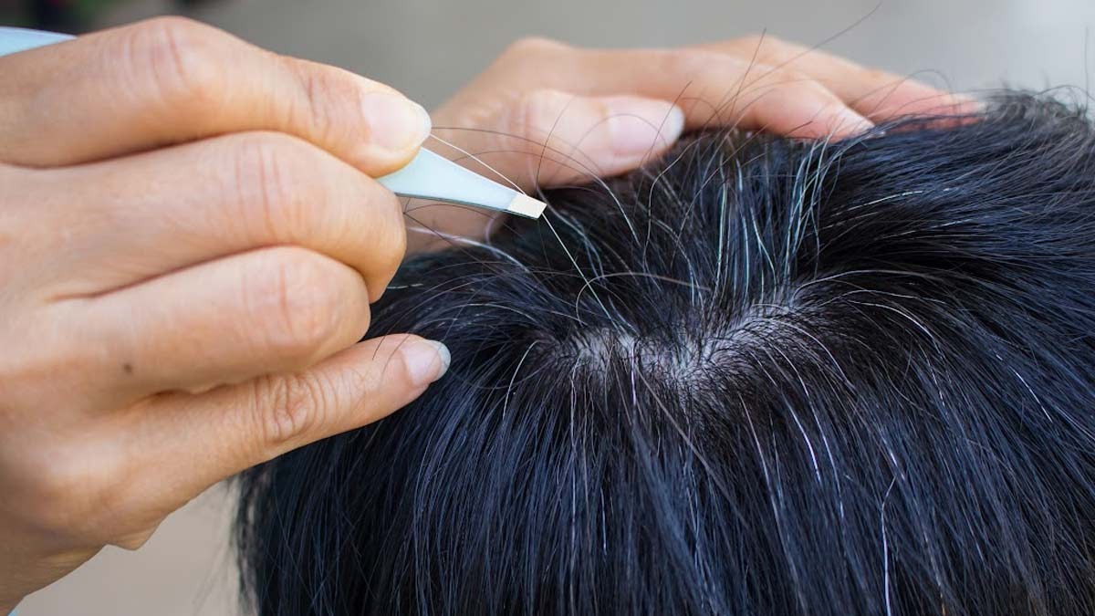 Trẻ em tóc bạc có sao không?