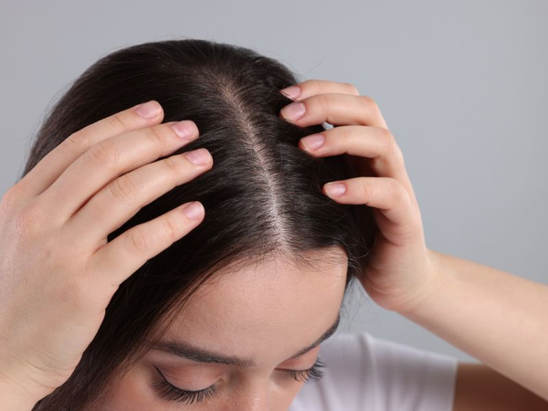 Nguyên nhân khiến mật độ tóc của bạn “thấp”