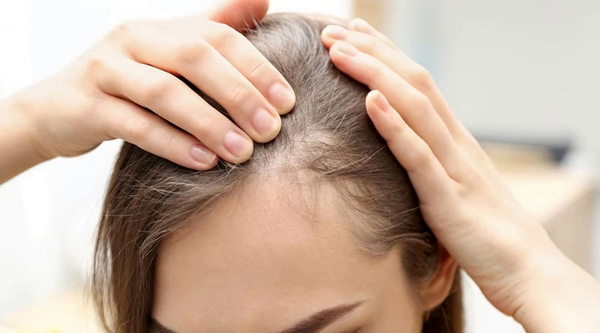 Tóc mỏng, thiếu độ phồng
