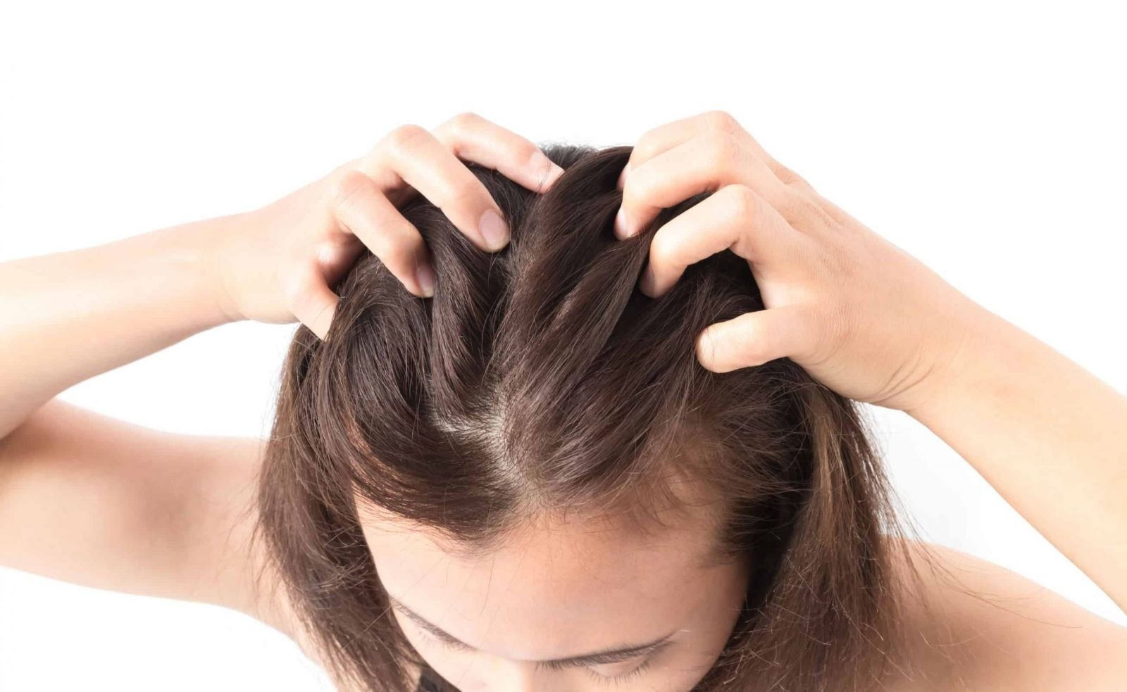 Cảm giác ngứa râm ran trên da đầu
