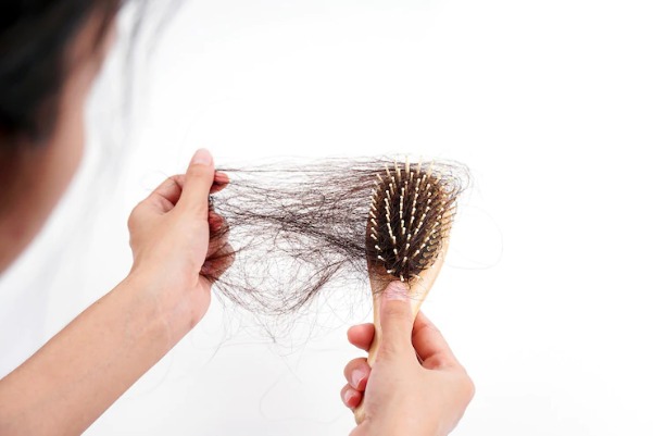 Tại sao giảm cân bị rụng tóc?