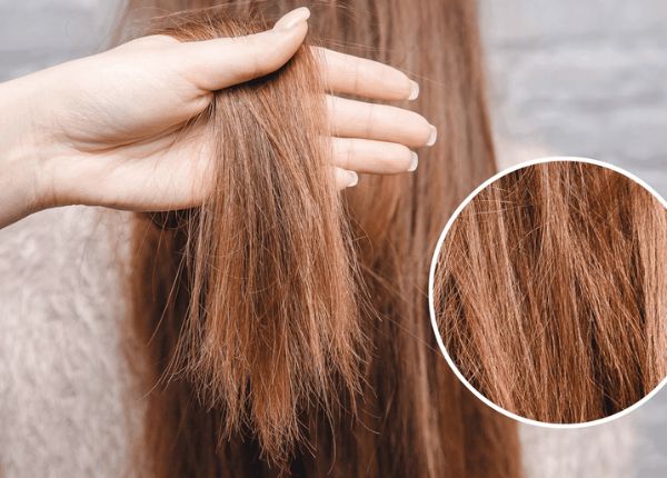 Phục hồi bằng tinh dầu thiên nhiên