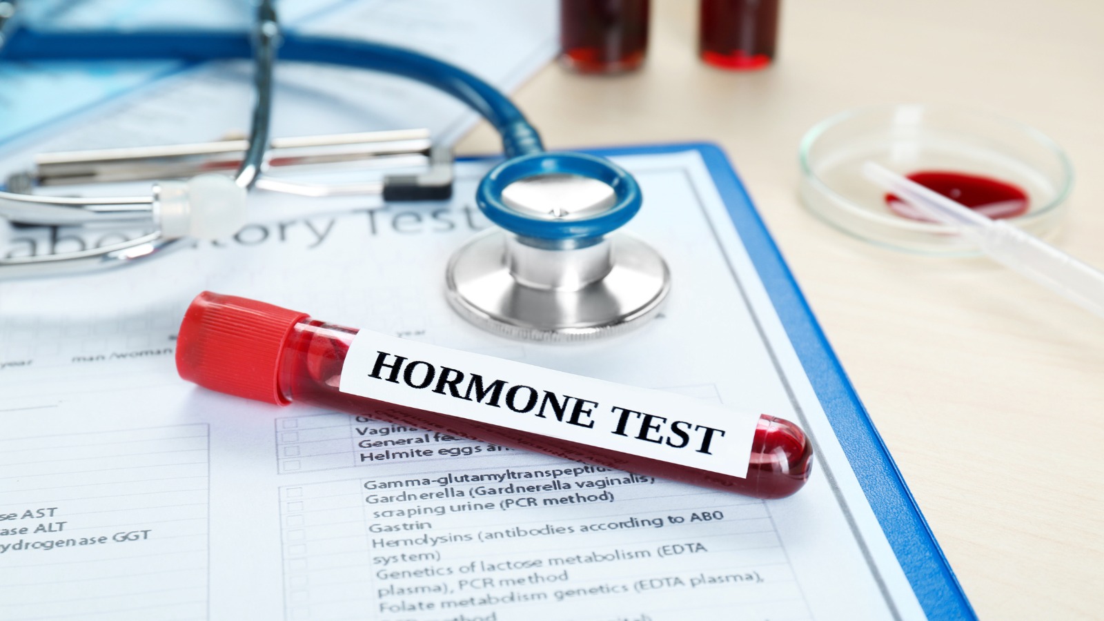 Xét nghiệm hormone
